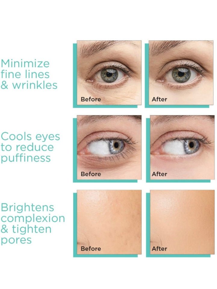 Ice globes facial massager - Wapas